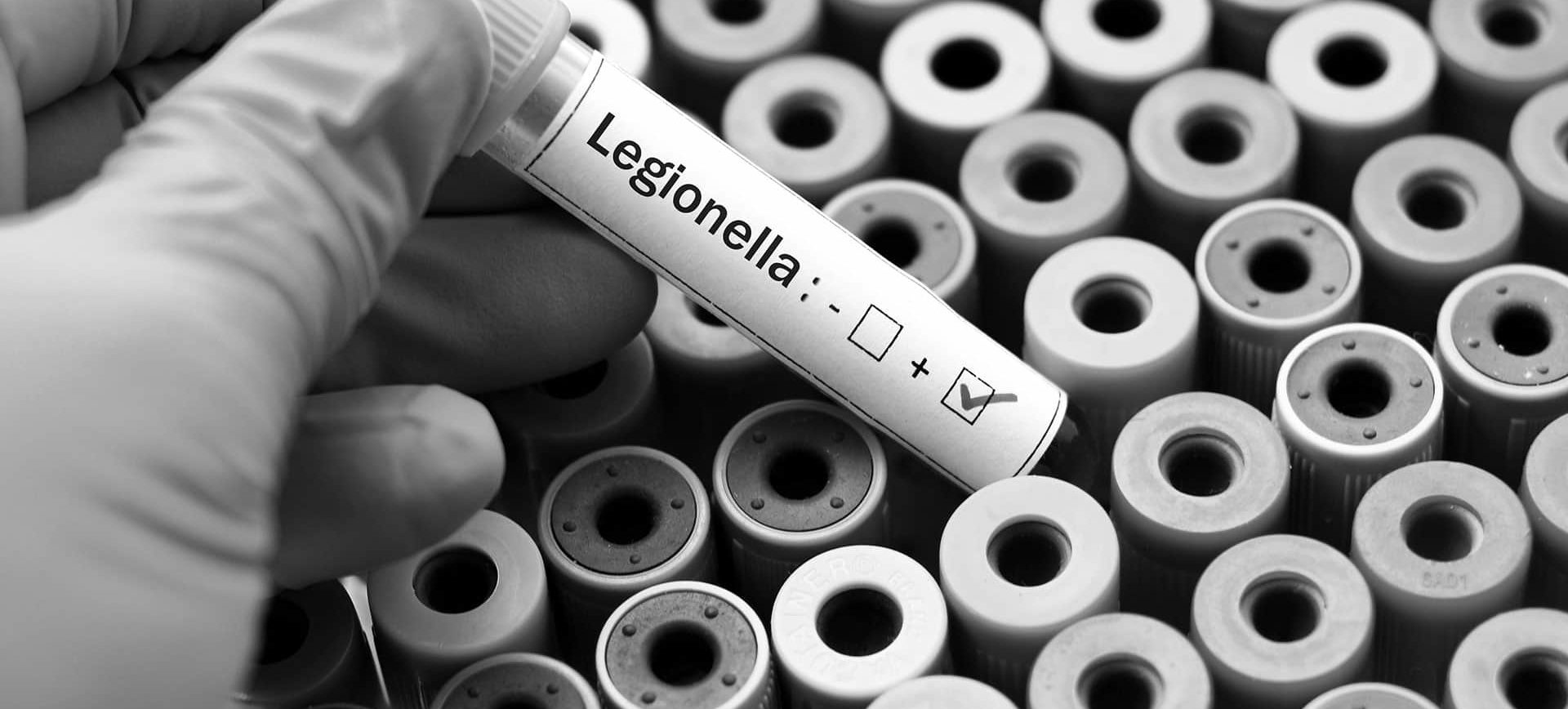 Legionella onderzoek testbuis