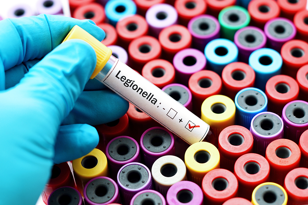 Legionella labbuis